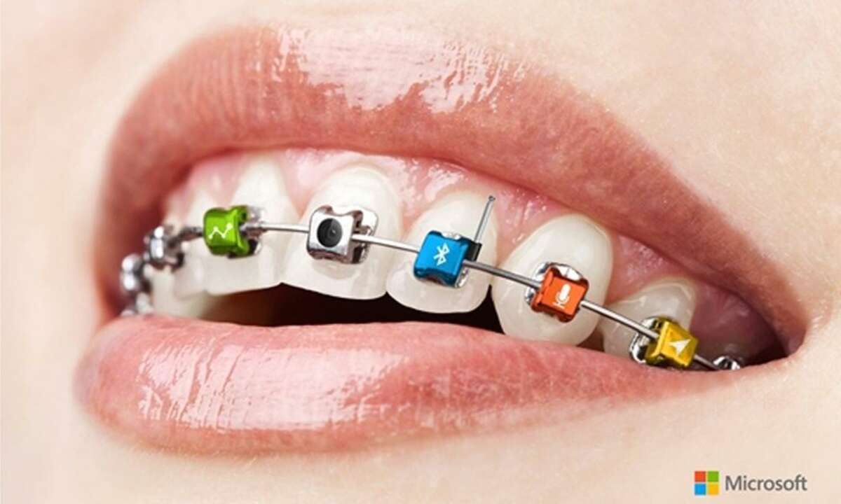 Microsoft Braces