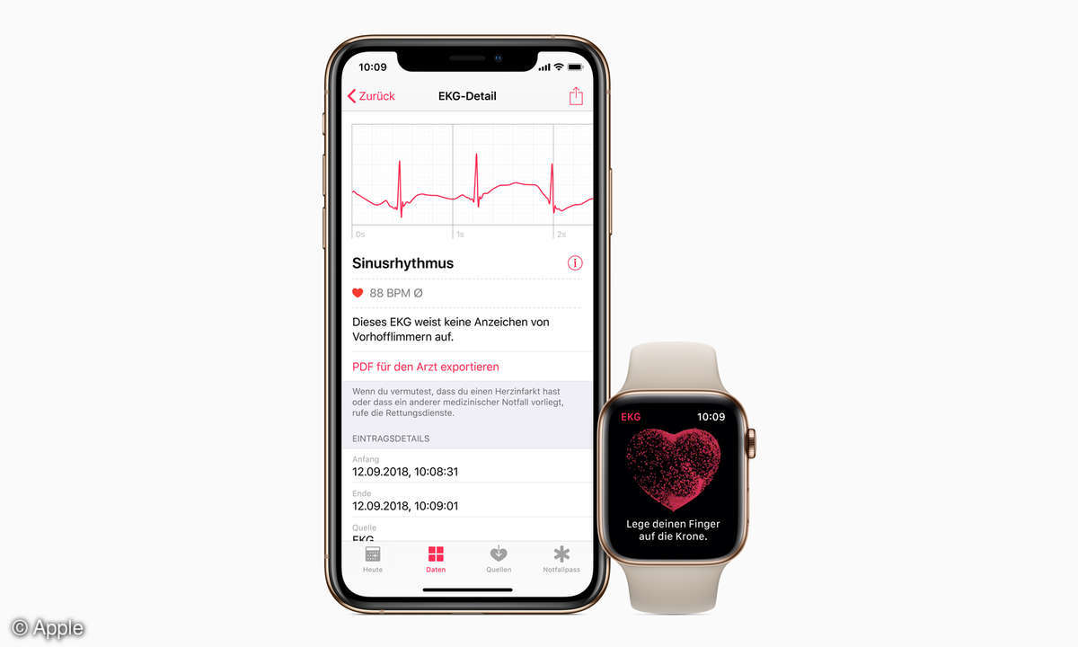 Apple Watch 4 EKG-App