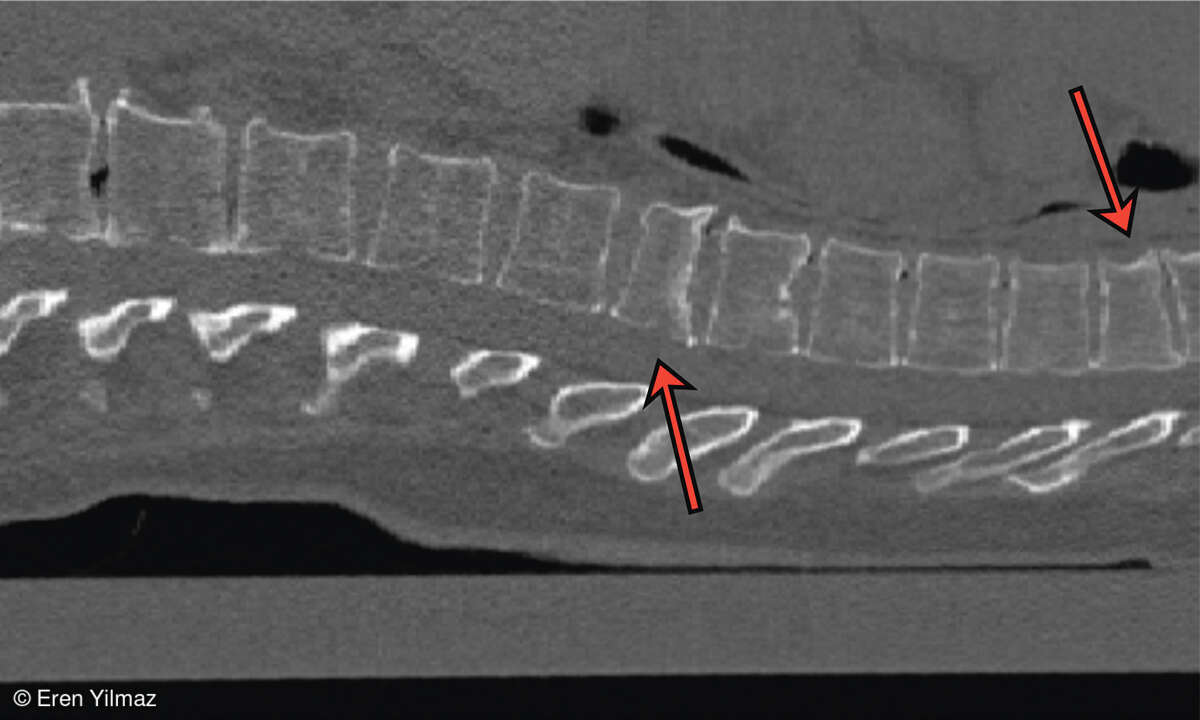 Gesundheits-Check mit Medizin-KIs: 2D-Schnittbild einer CT-Aufnahme