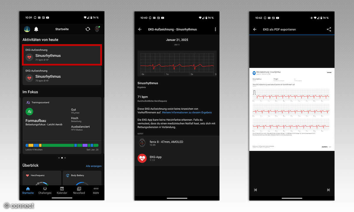 Garmin EKG-Messung einsehen connect-App