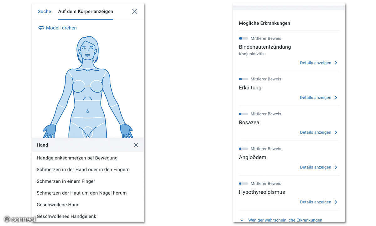 Wie zuverlässig funktionieren Symptom-Checker-Apps? Screenshots Symptomate