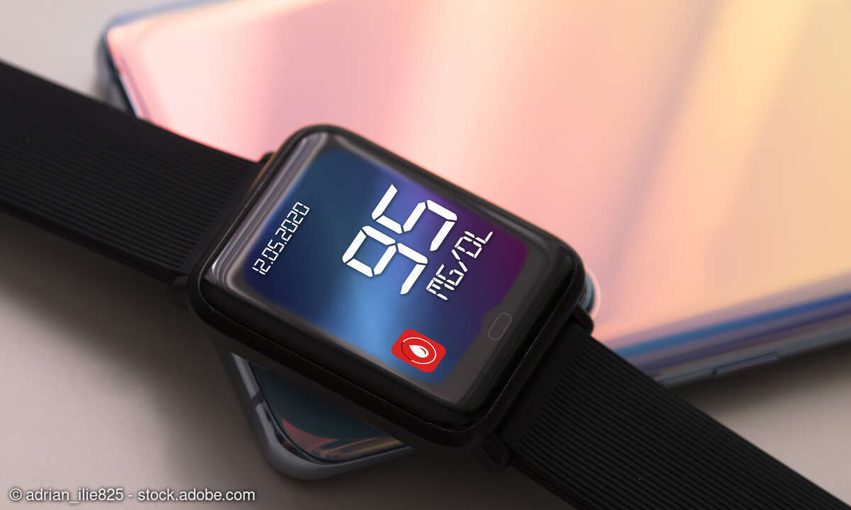 Smartwatch mit Blutzuckermessung