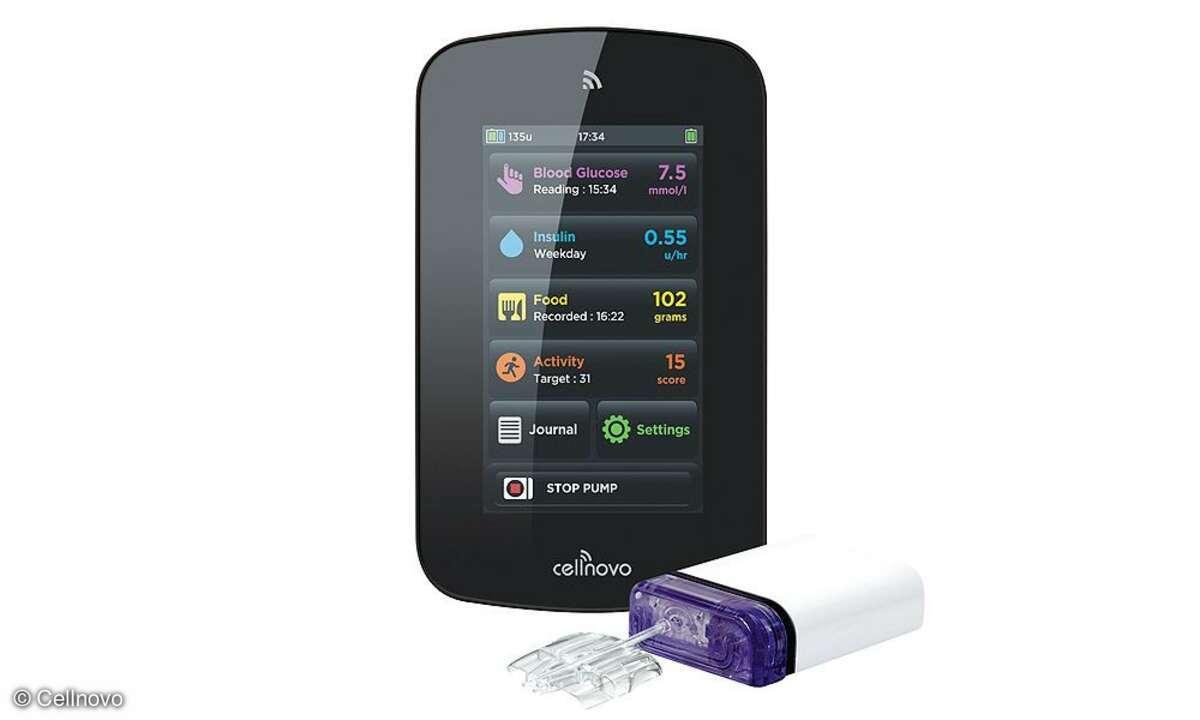 Cellnovo Insulin-Pumpe